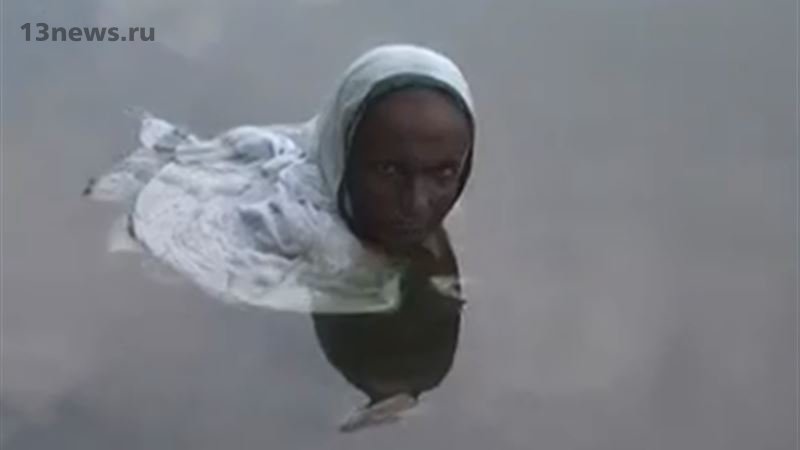 Женщина из Индии проводит 14 часов в день в воде из-за редкой болезни