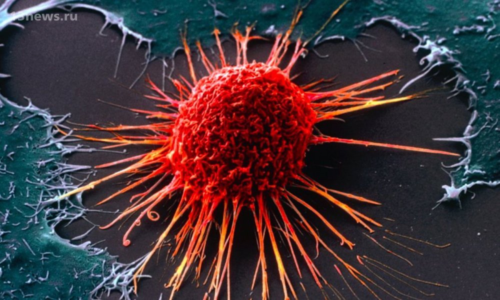 Учёные из США заявили, что нашли слабое место у раковых клеток