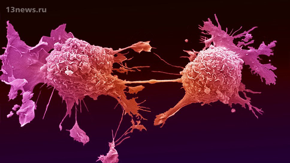 Появилась информация, что рак могут "победить" в скором времени
