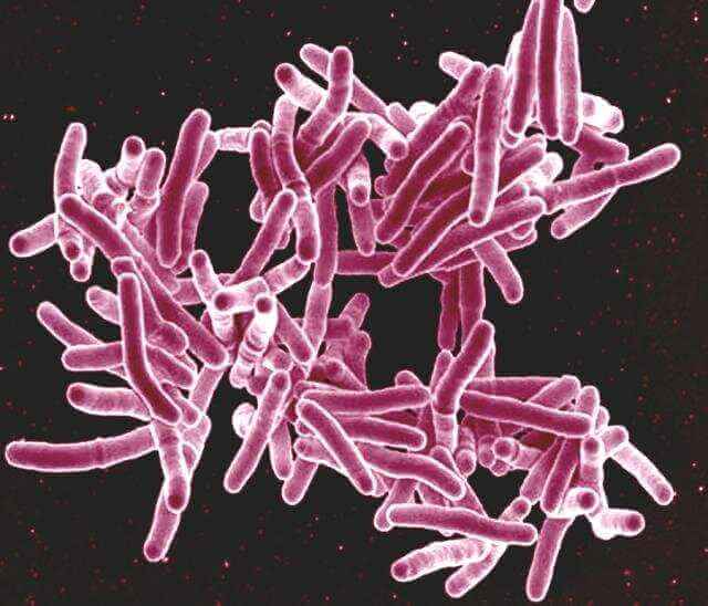 Найдена уязвимость в бактерии, вызывающей туберкулез