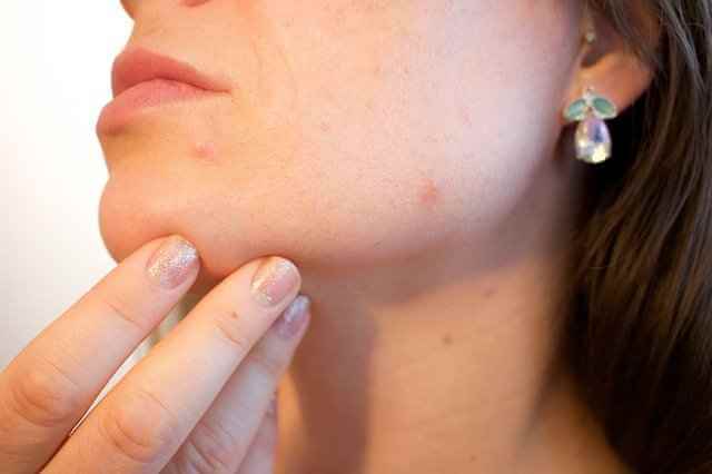Выявлены клеточные механизмы генетических заболеваний кожи